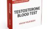 Testosterone Blood Test: A Guide for York Residents