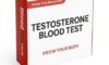Hair Loss Blood Test Options Available in Warrington, UK